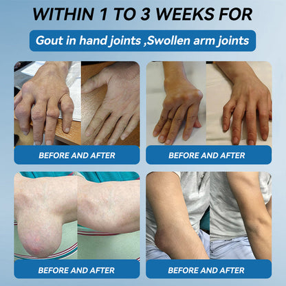 𝖯𝗂𝖼𝗱𝗼® BPC-157 Joint Healing Cream🦴Treats Arthritis, Neuropathy, Rheumatism, Sports Injuries & More👍