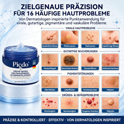🎁🎁𝐏𝐢𝐜𝐝𝐨® 𝟕-𝐓𝐚𝐠𝐞 𝐂𝐫𝐞𝐦𝐞 𝐆𝐞𝐠𝐞𝐧 𝐇𝐚𝐮𝐭𝐚𝐧𝐡ä𝐧𝐠𝐬𝐞𝐥- & 𝐏𝐢𝐠𝐦𝐞𝐧𝐭𝐟𝐥𝐞𝐜𝐤𝐞𝐧 (𝐒𝐜𝐡𝐦𝐞𝐫𝐳𝐟𝐫𝐞𝐢𝐞 𝐅𝐨𝐫𝐦𝐞𝐥 – 𝐨𝐡𝐧𝐞 𝐍𝐚𝐫𝐛𝐞𝐧)
